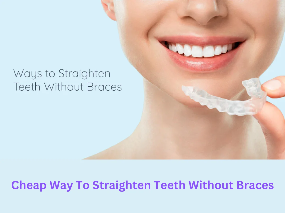 straighten teeth without braces
